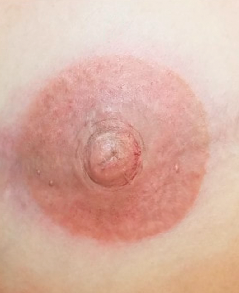 Micropigmentación areola mamaria Zaragoza